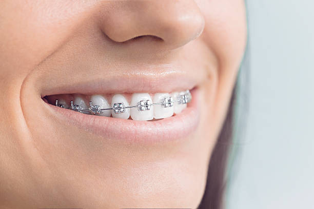 Best Preventive Dentistry  in Warm Mineral Springs, FL